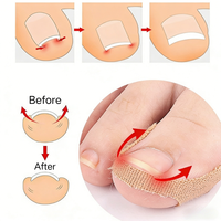 Lot de 5 autocollants correcteurs d'ongles incarnés, patchs élastiques pour ongles, correcteur de récupération, produits de pédicure et de soin des pieds