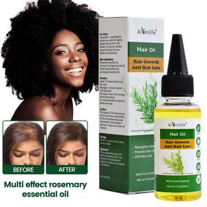 Huile multi-usages Chinaherbs 30 ml, très vendue, pour la croissance des cheveux, anti-chute, nourrit le cuir chevelu, huile fortifiant les cheveux - Product Image 1