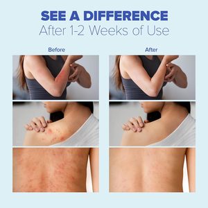 <span class=keywords><strong>ครีม</strong></span>แก้คันกลากเกลื้อนสำหรับมนุษย์ผิวหนังสำหรับแก้คันขี้กลากสำหรับนักกีฬารักษาเท้าผื่นคันผื่นคันบรรเทาอาการระคายเคือง - Product Image 3