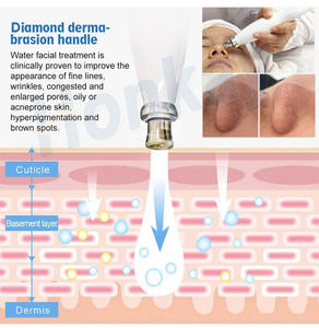 Máquina Facial de Oxígeno Jet Peel 8 en 1 Eficaz para Blanquear la Piel y Mejorar la Elasticidad del Tono de la Piel - Product Image 5