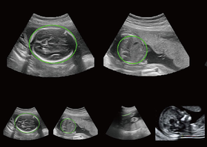 Sono Series High-End Veterinair Ultrasone Systeem 4D AI-Gestuurde Precisie Diagnostiek & Geavanceerde Workflow Volledige Lichaamsafbeelding van Huisdieren - Product Image 5