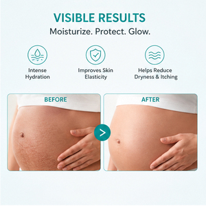 Crème Corporelle Hydratante et Apaisante pour Peaux Sèches et Anti-Vergetures, Nourrissante pour Mères - Vente en Gros - Product Image 2