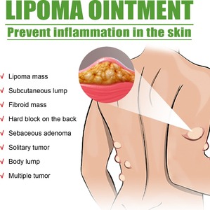 Crema Reductora de Grasa OUHOE, Elimina Diversos Tipos de Grasa Corporal, Nódulos Subcutáneos, Crema para el Cuidado Corporal - Product Image 3