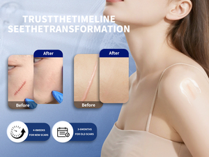 Gel cicatrisant en silicone de qualité médicale et feuilles semi-solides pour les cicatrices du visage, du corps, des jambes, des bras et des cicatrices de césarienne - Product Image 5