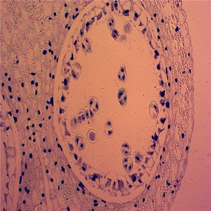 Giảng dạy y tế reaources chuẩn bị Slide thực vật học meiosis thiết lập tùy chỉnh nhà máy chuẩn bị mitosis & mitosis chuẩn bị Slide Slide - Product Image 2
