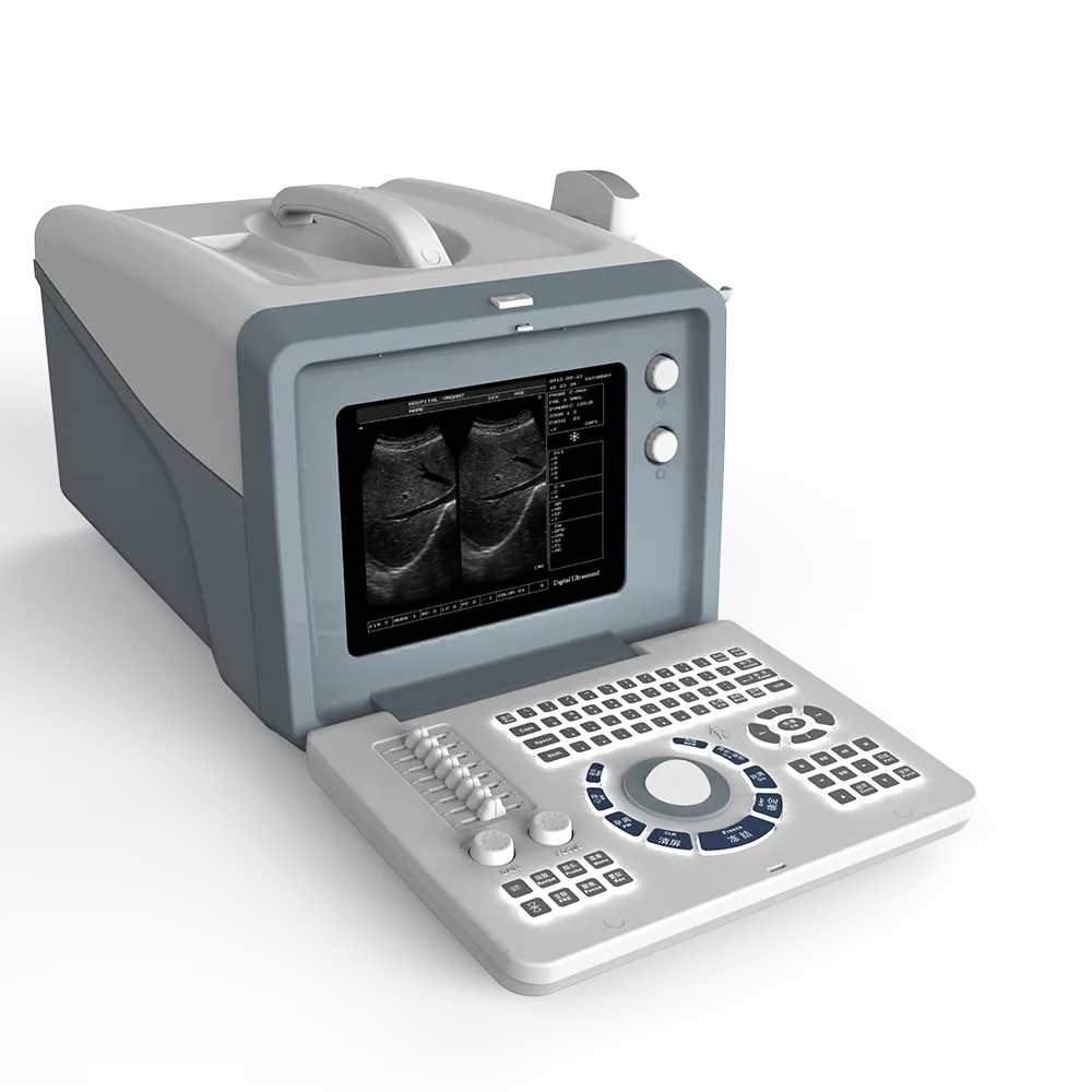 Wholesales Handheld High Image Quality Black and White Portable Ultrasound Machine