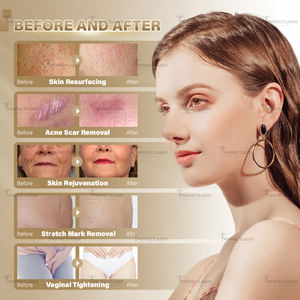 Máquina de láser de Tulio de longitud de onda dual de 1927nm y 1550nm, equipo de belleza de estiramiento vaginal para rejuvenecimiento de la piel de fibra láser de diodo - Product Image 6