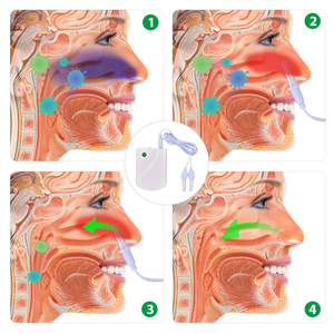 Máquina de Tratamiento de Rinitis Fitease, Nariz Tapada, <span class=keywords><strong>Sinusitis</strong></span> Nasal, Resfriado, Alivio de Alergias, Dispositivo de Terapia, Material ABS - Product Image 3