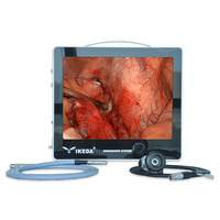 Système de caméra endoscopique médicale portable IKEDA YKD-9115 avec écran LCD HD 1080P pour ORL, usage hospitalier, oreille, nez, gorge, garantie 2 ans