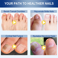 Traitement antifongique pour les ongles des orteils à base de plantes, oregano et arbre à thé, favorise la croissance des ongles, hydrate en profondeur, solution réparatrice pour les ongles, 10ml
