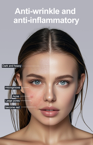 Đa Chức Năng Mặt Chăm Sóc Da RF EMS Da Thắt Chặt Nâng Làm Mát <span class=keywords><strong>Massage</strong></span> Loại Bỏ Nếp Nhăn Da Mặt Chống Lão Hóa Thiết Bị - Product Image 4