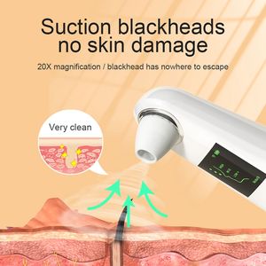 Aspirateur de pores visuel personnalisé en usine avec dissolvant de points noirs chauds et froids avec caméra HD - Product Image 4