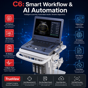 Système d'échographie Doppler couleur portable professionnel médical numérique C6pro-02 Advanced Trueview - Product Image 4