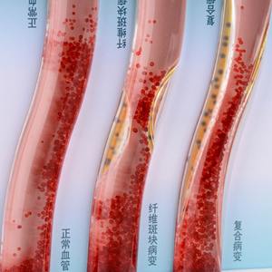 PVC人体动态高脂血症血管堵塞模型中血液稠度流的演示与比较 - Product Image 5