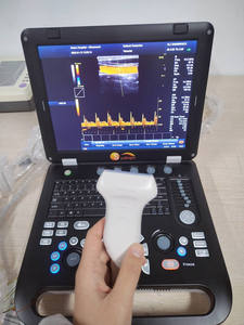 Échographe portable numérique couleur 3D Doppler Jm-906a pour usage humain - Product Image 6