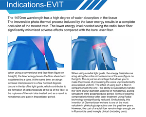 Laser Diode EVLT EVLA 980nm 1470nm 50W 3000ms, liệu pháp cắt bỏ tĩnh mạch bằng laser qua tĩnh mạch cho chứng giãn tĩnh mạch ở chân - Product Image 3