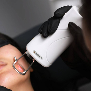 Laser Thulium sóng 1927nm điều trị nám, Laser Erbium Thulium vi điểm 1927 & 1550, Laser không vi điểm 1550 & 1927 - Product Image 3