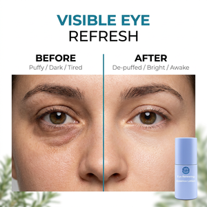 Suero Iluminador para Ojos, Tratamiento para Ojeras, Esencia Renovadora con Péptidos para Ojos Cansados y Opacos - Product Image 5
