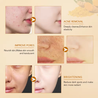 Crème hydratante pour le visage au curcuma biologique, anti-taches et régulatrice de sébum