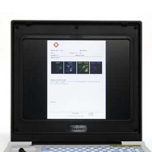 Beste prijs draagbare echografiemachine, veterinaire echografie, zwart-wit echografie scanner, ecografos veterinarios - Product Image 3