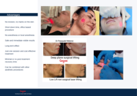 Laser diode médical portable pour lipolyse avec système de refroidissement pour la réduction des graisses