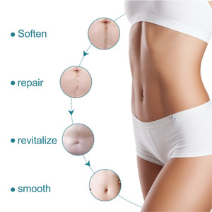 Tecnologia Avançada Silicone Scar Sheets Customizável Tamanho Melhora Cura Clareia Cicatrizes Feitas com Extratos Vegetais Naturais - Product Image 4