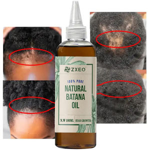 Private Label 100% Pure Natural Raw Batana <span class=keywords><strong>Oil</strong></span> Bulk Anti Hair Loss Tratamento Reparação Danificado Batana Soro De Crescimento Do Cabelo - Product Image 2