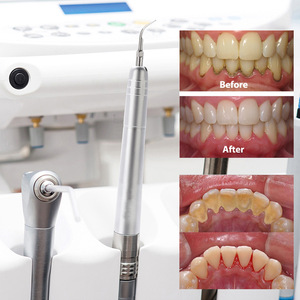 Máquina de limpieza dental neumática de 2/4 orificios con turbina de bajo ruido para limpieza de dientes, equipo certificado CE - Product Image 1