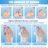 Ventes directes d'usine Sortie de nouveau produit: modèle de bouton haut de gamme gris, correcteur Hallux Valgus personnalisable