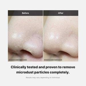 Crema Coreana Medi Cbe Zero Pore para el Cuidado de la Piel, Venta al por Mayor, Personalizada, Limpieza Profunda Diaria, Eliminador de Puntos Negros, Blanqueadora, Control de Grasa - Product Image 5