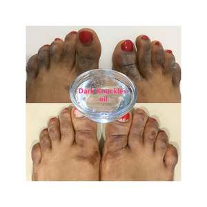 Siero Sbiancante alla Vitamina C per Viso, Rimuove Macchie Scure, <span class=keywords><strong>Melanina</strong></span> e Acido Ascorbico per Articolazioni e Nocche - Product Image 1