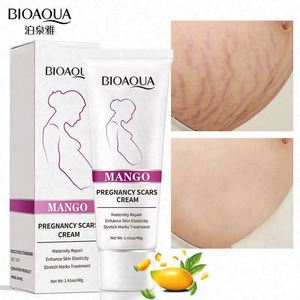 妊娠纹霜工厂 OEM ODM 芒果身体产后恢复去除 - Product Image 3