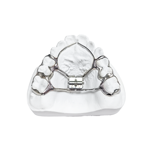 <span class=keywords><strong>Appareil</strong></span> d'expansion <span class=keywords><strong>dentaire</strong></span> amovible de classe II, plaque orthodontique en acrylique pour le redressement des dents, personnalisation - Product Image 3