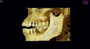 <span class=keywords><strong>Prix</strong></span> de la machine à rayons X panoramiques dentaires 2D/3D CBCT - Product Image 3