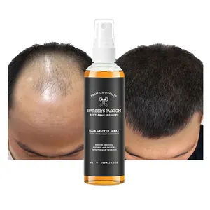 Wholesale Pure Natural Herbal Formula Promotes Thicker Stronger Hair Growth Oil Serum Hair Loss Treatment Regrowth for Men Women