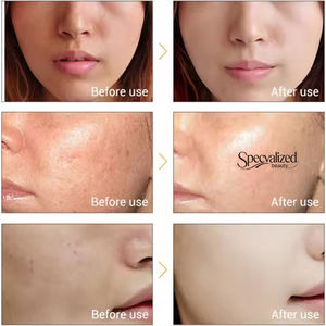 Private Label vitamina C acido Kojic cura della pelle glutatione siero sbiancante per la pelle del viso per la rimozione delle macchie scure - Product Image 5