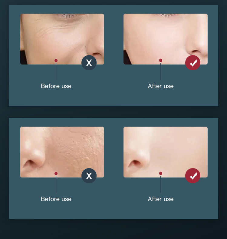 New 7 Color Skin Tightening Nano Spray Facial Panel Face Mask PDT LED Light Therapy Device With Steamer