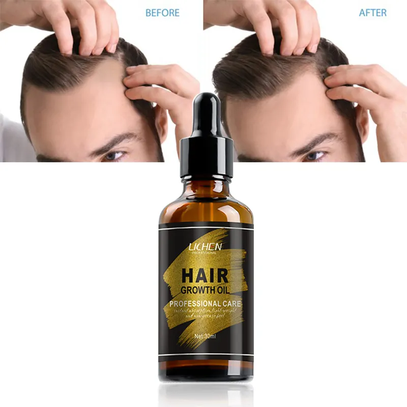 Top Selling Lichen Haargroei Serum Argan Haar Olie Voor Haarverzorging