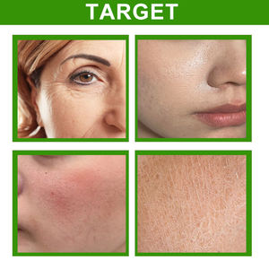 Offre Spéciale OEM éclaircissant <span class=keywords><strong>Anti</strong></span>-rides raffermissant <span class=keywords><strong>Anti</strong></span>-âge <span class=keywords><strong>Anti</strong></span>-rougeurs raffermissant raffermissant la peau réparatrice pour les peaux sensibles - Product Image 6