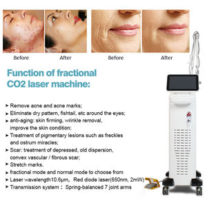 Machine à laser CO2 fractionné de technologie avancée pour la révision des cicatrices, l'élimination des grains de beauté, le resserrement des zones intimes et le traitement des vergetures - Product Image 6
