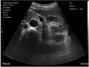 B26G perangkat <span class=keywords><strong>Ultrasound</strong></span> linier jantung cembung, nirkabel genggam dengan pencitraan Digital canggih - Product Image 5