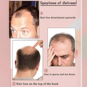 Perruque pour <span class=keywords><strong>homme</strong></span>, postiche capillaire naturel, invisible et sans couture, avec mécanisme de coiffage arrière, pour un look élégant - Product Image 2