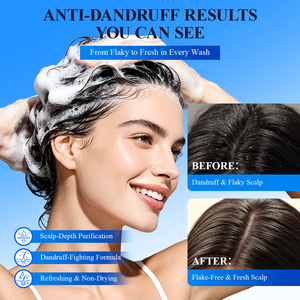 Shampooing antipelliculaire formule professionnelle pour salon, marque privée, logo personnalisé, fournisseur de soins capillaires véganes et biologiques, sans sulfate. - Product Image 3