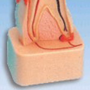 Ada รูปแบบการสลายตัวของฟันทางการแพทย์ขององค์กรและรอยโรคฟันรูปแบบการสลายตัวทางพยาธิวิทยาที่ครอบคลุม - Product Image 4