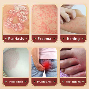 ครีมเจลสมุนไพรบรรเทาอาการคัน ขายดี สำหรับปัญหาผิวหนัง เช่น รอยแดง <span class=keywords><strong>บวม</strong></span> คัน และสะเก็ดเงิน - Product Image 3