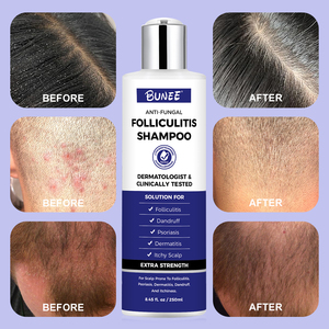 250ml Shampooing crème nourrissante rafraîchissante pour folliculite cuir chevelu <span class=keywords><strong>psoriasis</strong></span> séborrhéique conditionneur liquide à base de plantes hydratant - Product Image 1