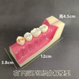 โมเดลฟัน Dt Dental รุ่น Mx-2 แบบถอดประกอบได้ พร้อมแม่เหล็ก สำหรับการเรียนการสอน ขนาด 11*4*5.3 ซม. สำหรับทำความสะอาดและอุดฟัน อุปกรณ์ทันตกรรม - Product Image 3