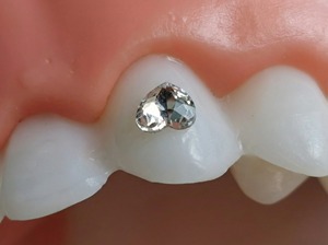 Gioielli Dentali a Forma di Cuore in Cristallo - Gemme Dentali Premium per un <span class=keywords><strong>Sorriso</strong></span> Scintillante, Gioielli in <span class=keywords><strong>Stile</strong></span> Hip Hop Punk - Product Image 5