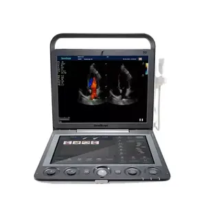 Escáner de ultrasonido portátil Instrumentos de ultrasonido médico Marca famosa Sonoscape S9 3D 4D Máquina de ultrasonido Doppler a color