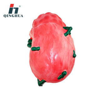 Modèle d'agrandissement des ganglions lymphatiques Qinghua : Instruments et équipements pédagogiques pour les cours de biologie au collège et au lycée - Product Image 2